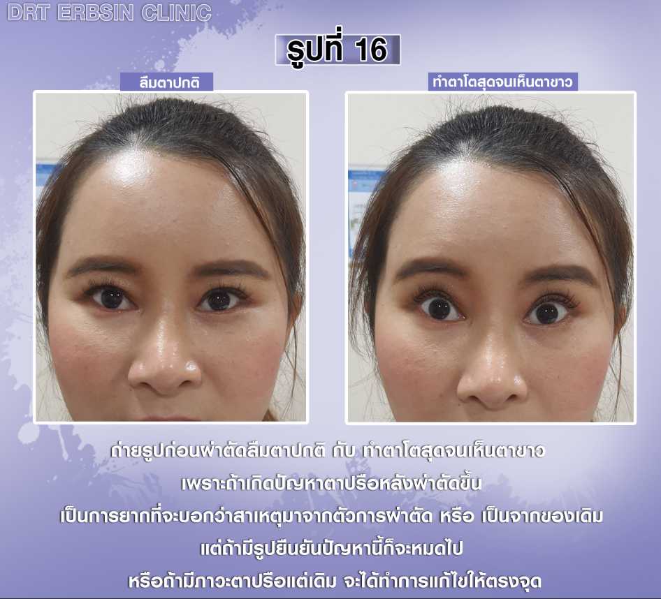 รูปลืมตาปกติและทำตาโต รูปลืมตาปกติและทำตาโต