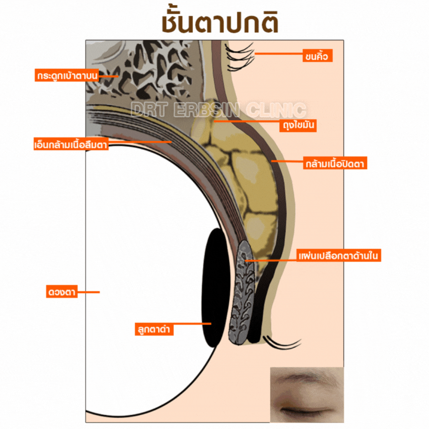 การลืมตาใน คนปกติ การลืมตาใน คนปกติ
