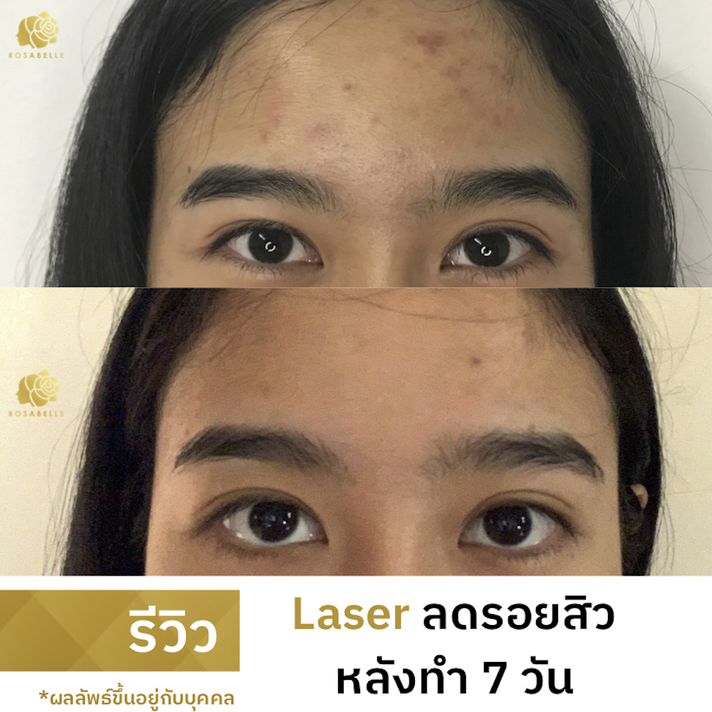 My Image 29