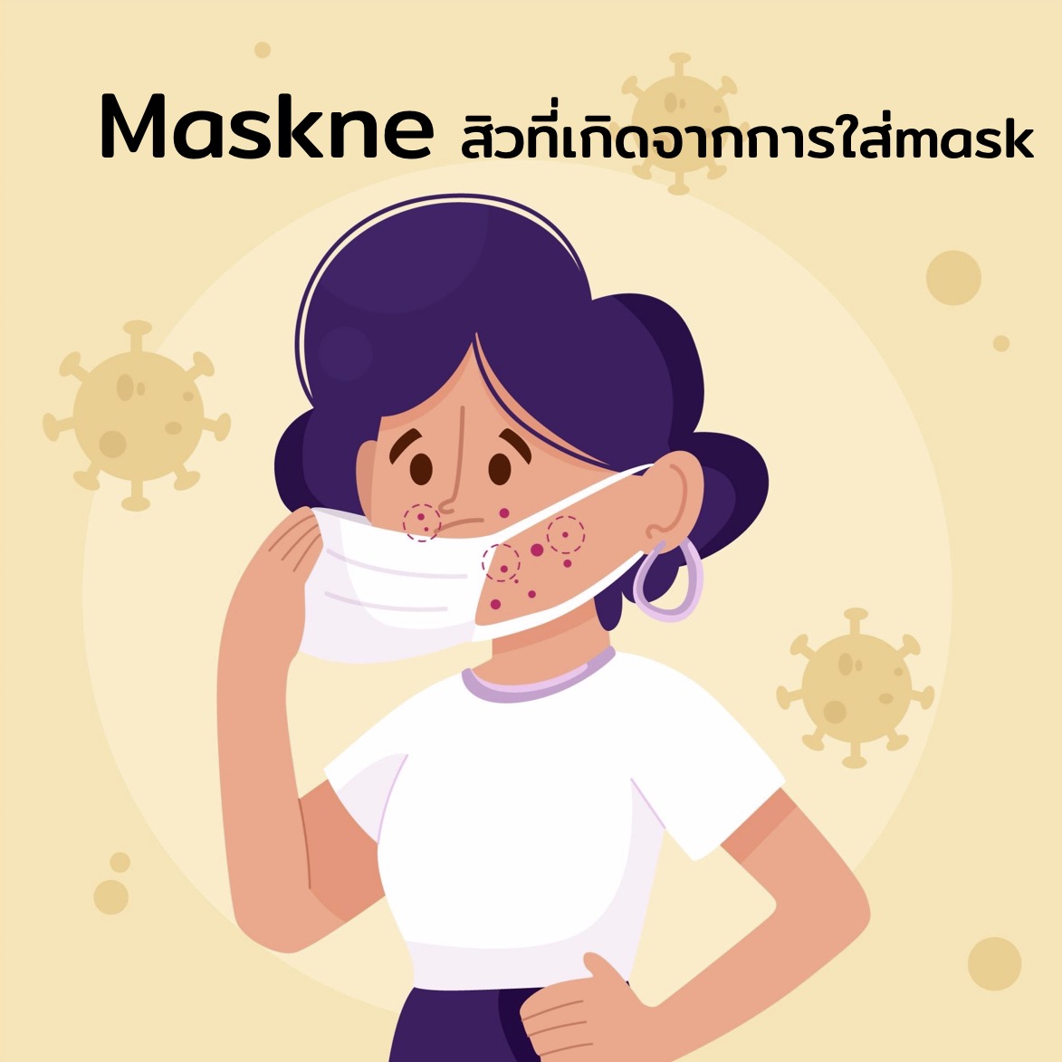Maskne (Mask acne)
