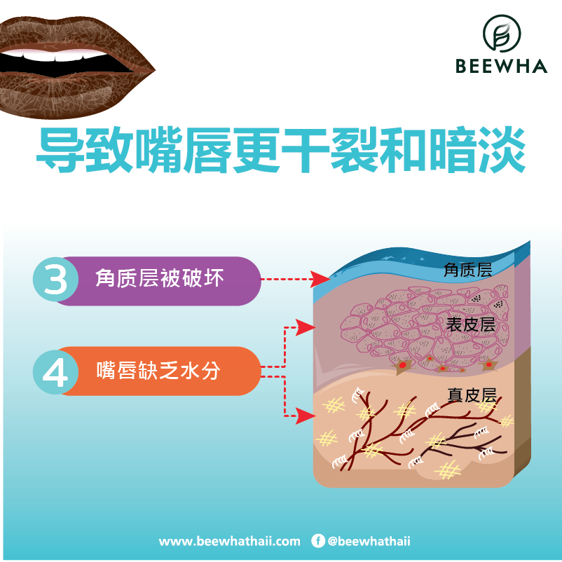 导致嘴唇更干裂和暗淡_Beewha 导致嘴唇更干裂和暗淡_Beewha