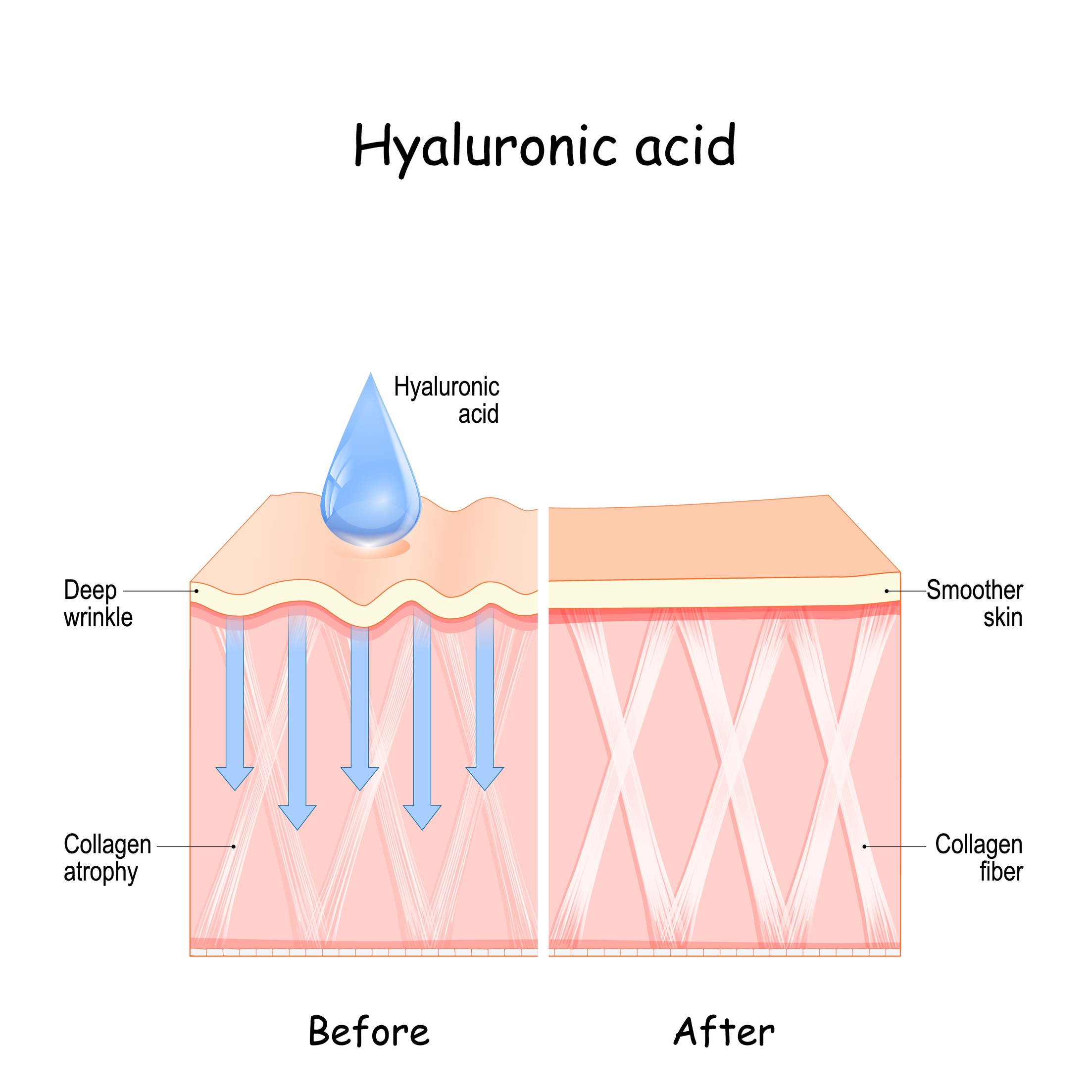 Hyaluronic acid creameryplus