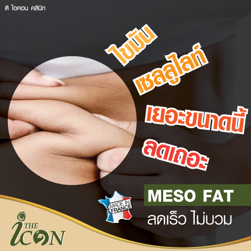 Meso Fat การฉีดสลายไขมันส่วนเกิน คืออะไร 