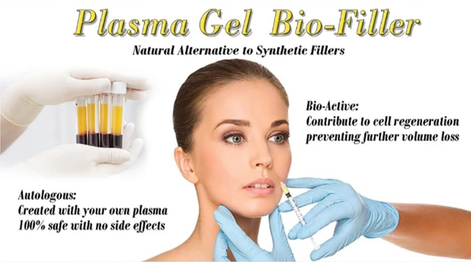 Plasma Bio Gel Filler นวัตกรรมใหม่ล่าสุด ฟิลเลอร์บริสุทธิ์ ที่สกัดจากเลือดของผู้เข้ารักษาเอง 100%