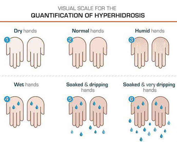 ภาวะเหงื่อออกมาก (Hyperhidrosis) คืออะไร ดูแลได้อย่างไร