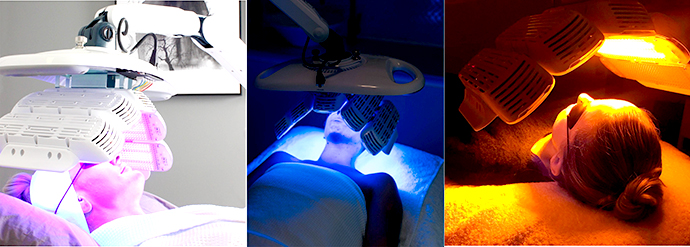 Healite LED Therapy Treatment เทคโนโลยีแสงเพื่อการรักษาและฟื้นฟูผิวจากอเมริกา  “เทคโนโลยีการใช้แสงเพื่อการรักษาและฟื้นฟูผิว