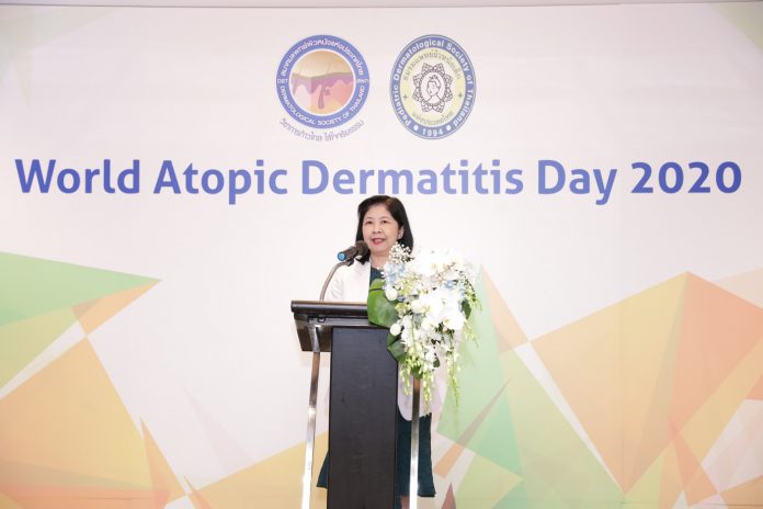 ศ.พญ. กนกวลัย กุลทนันทน์ นายกสมาคมแพทย์ผิวหนังแห่งประเทศไทย กล่าวว่า “ทุกวันที่ 14 กันยายนของทุกปีเป็น วันโรคผื่นภูมิแพ้ผิวหนังโลก หรือ World Atopic Dermatitis Day 