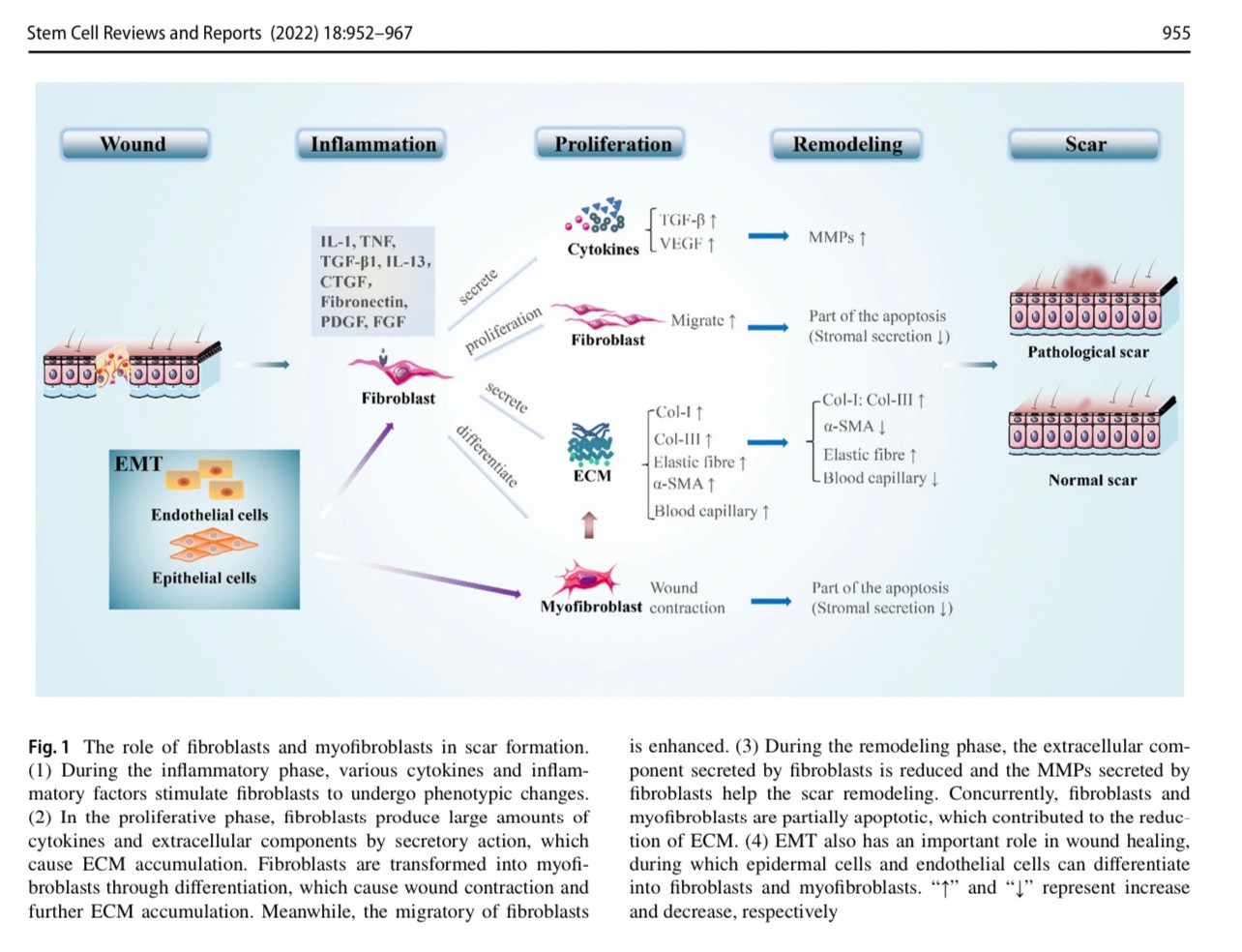 แนะนำเทคนิคดูแลแผลเป็น: Exosome ในการดูแลแผลและแผลเป็น Exosome Therapy in Wound and Scar Management แนะนำเทคนิคดูแลแผลเป็น: Exosome ในการดูแลแผลและแผลเป็น Exosome Therapy in Wound and Scar Management