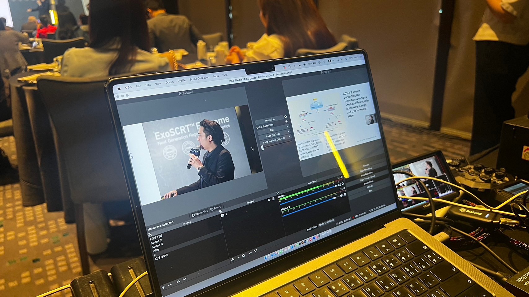 ผศ.นพ. ศุภะรุจ เลื่องอรุณ (หมอรุจ) ได้รับเชิญเป็นวิทยากร แชร์เทคนิคๆการดูแลหลุมสิว แผลเป็น ผมร่วงผมบางด้วยการใช้ Exosomes ในงานสัมมนา The Aesthetic Secret of Exosome based on Scientific Data ผศ.นพ. ศุภะรุจ เลื่องอรุณ (หมอรุจ) ได้รับเชิญเป็นวิทยากร แชร์เทคนิคๆการดูแลหลุมสิว แผลเป็น ผมร่วงผมบางด้วยการใช้ Exosomes ในงานสัมมนา The Aesthetic Secret of Exosome based on Scientific Data