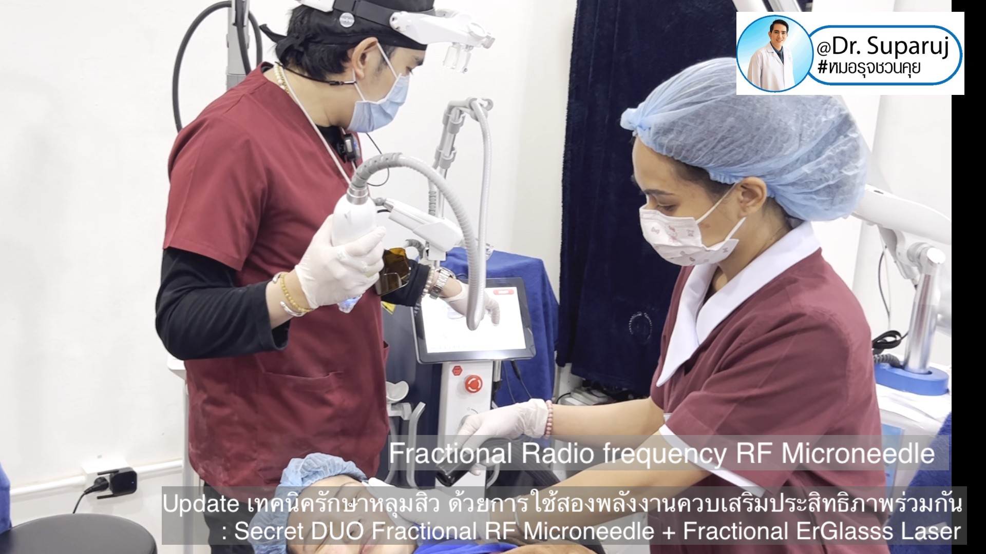 Update เทคนิครักษาหลุมสิว ด้วยการใช้สองพลังงานเสริมประสิทธิภาพร่วมกัน: Secret DUO Fractional RF Microneedle + Fractional ErGlasss Laser