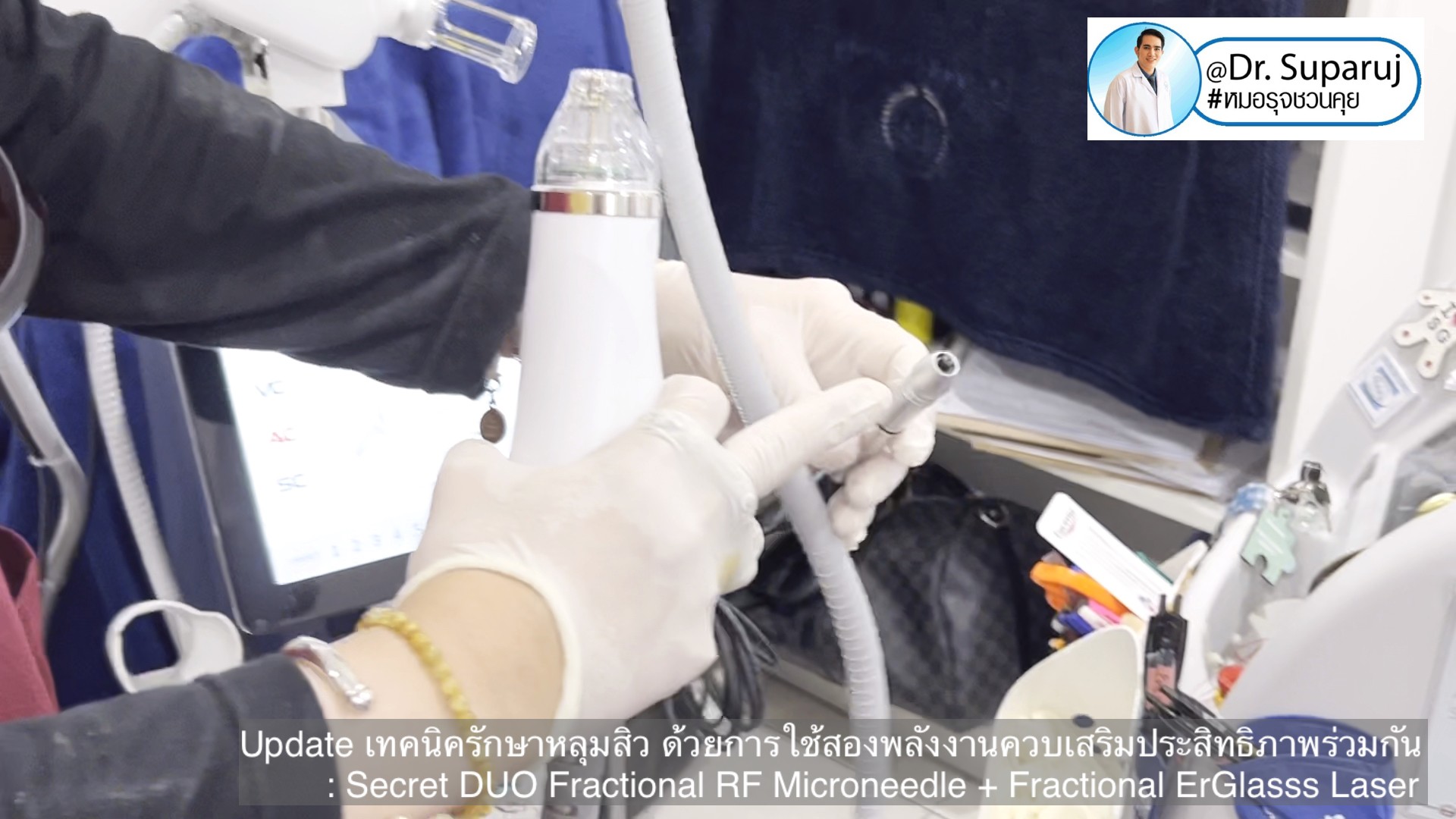 Update เทคนิครักษาหลุมสิว ด้วยการใช้สองพลังงานเสริมประสิทธิภาพร่วมกัน: Secret DUO Fractional RF Microneedle + Fractional ErGlasss Laser