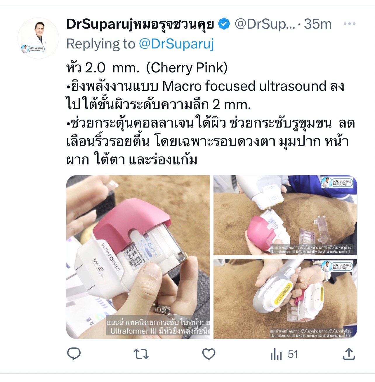 แนะนำเทคนิคยกกระชับใบหน้า: ยกกระชับใบหน้าด้วย Ultraformer III มีหัวยิงพลังกี่ชนิด & ช่วยเรื่องอะไร ? แนะนำเทคนิคยกกระชับใบหน้า: ยกกระชับใบหน้าด้วย Ultraformer III มีหัวยิงพลังกี่ชนิด & ช่วยเรื่องอะไร ?