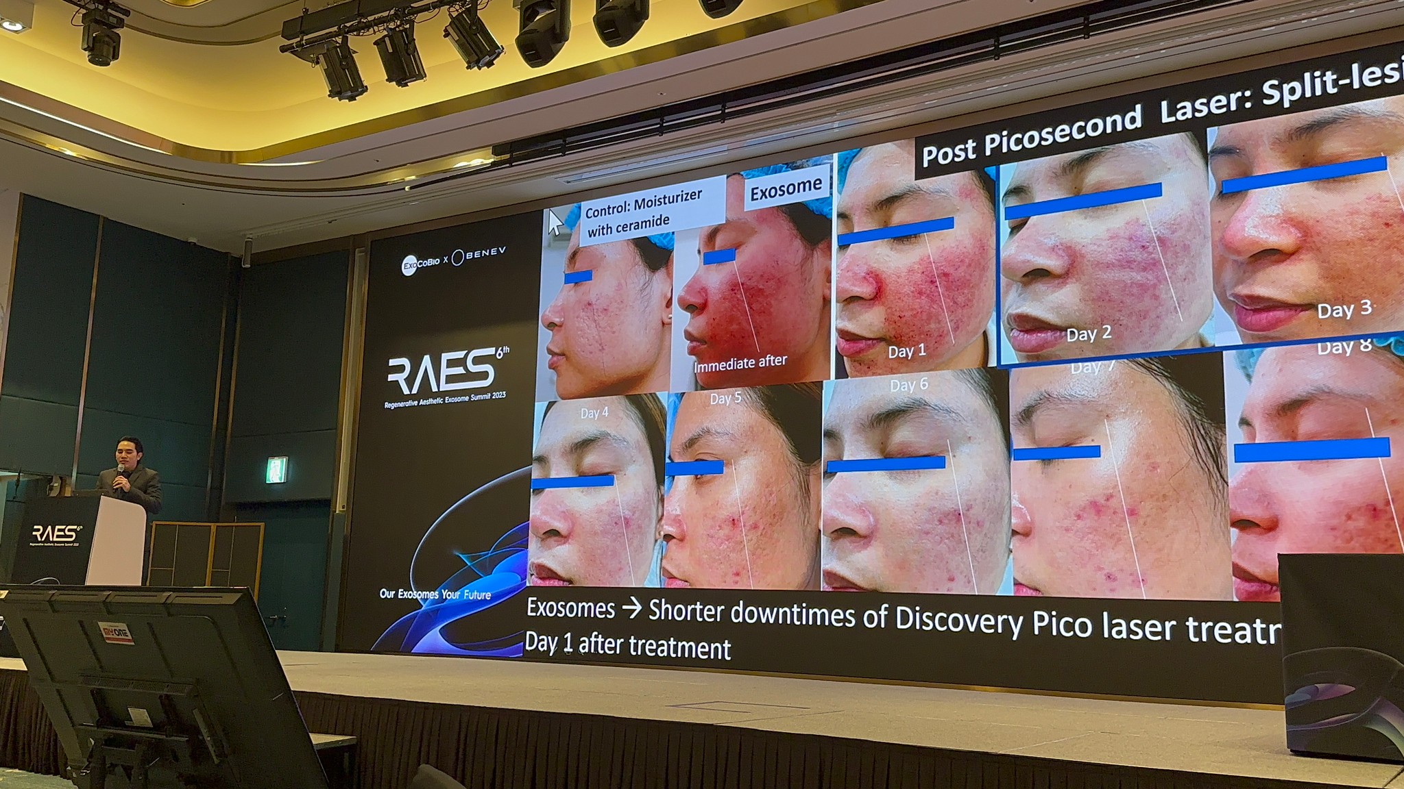 ผู้ช่วยศาสตราจารย์ นายแพทย์ ศุภะรุจ เลื่องอรุณ (หมอรุจ) ได้รับเกียรติร่วมบรรยาย Clinical Aplication of Exosomes และได้รับรางวัล CLINICAL CASE Award ผู้ช่วยศาสตราจารย์ นายแพทย์ ศุภะรุจ เลื่องอรุณ (หมอรุจ) ได้รับเกียรติร่วมบรรยาย Clinical Aplication of Exosomes และได้รับรางวัล CLINICAL CASE Award