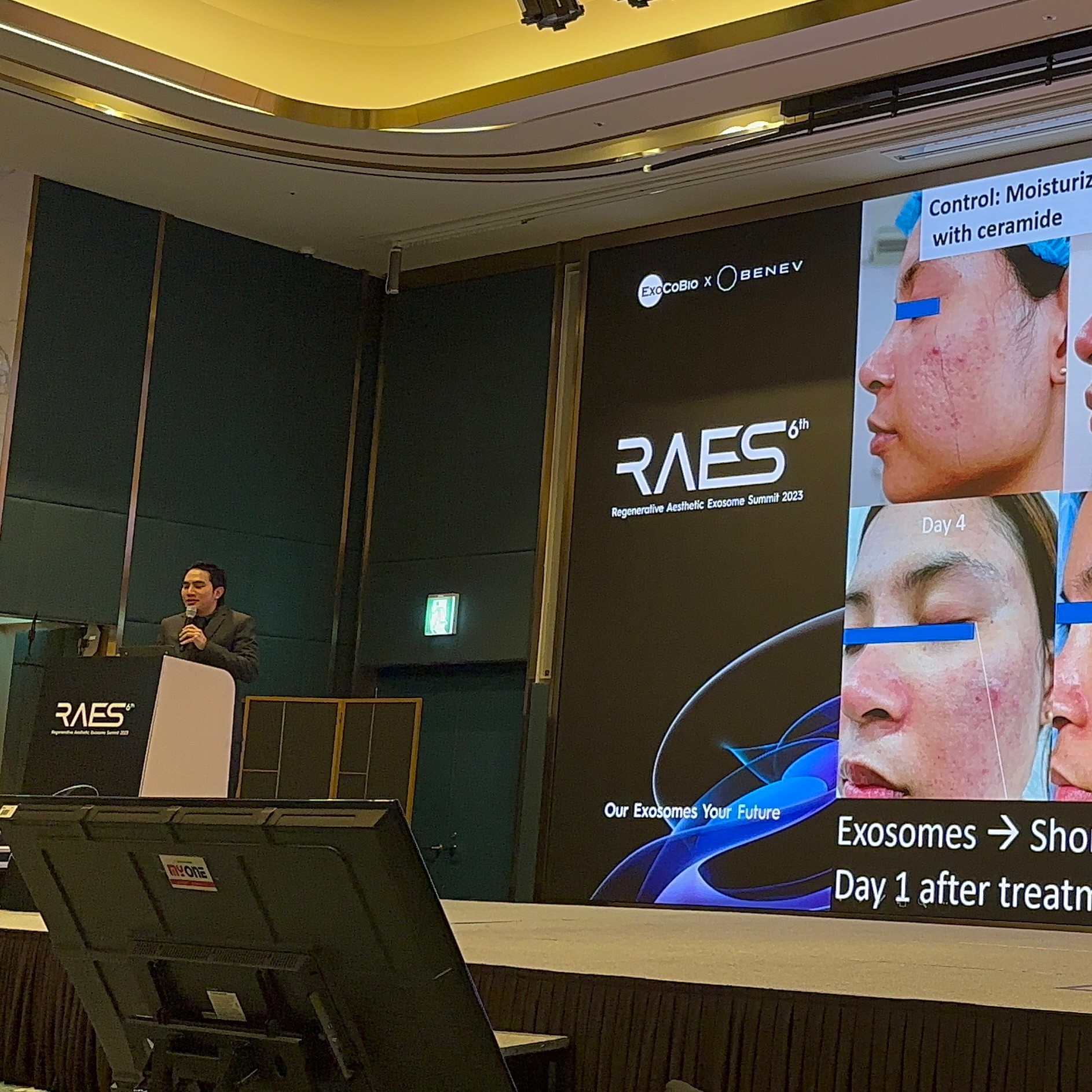 ผู้ช่วยศาสตราจารย์ นายแพทย์ ศุภะรุจ เลื่องอรุณ (หมอรุจ) ได้รับเกียรติร่วมบรรยาย Clinical Aplication of Exosomes และได้รับรางวัล CLINICAL CASE Award ผู้ช่วยศาสตราจารย์ นายแพทย์ ศุภะรุจ เลื่องอรุณ (หมอรุจ) ได้รับเกียรติร่วมบรรยาย Clinical Aplication of Exosomes และได้รับรางวัล CLINICAL CASE Award