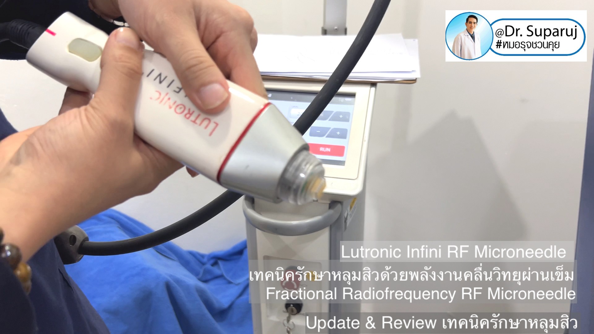 Update & Review เทคนิครักษาหลุมสิว (Acne Scar Treatment: Update & Review) Update & Review เทคนิครักษาหลุมสิว (Acne Scar Treatment: Update & Review)