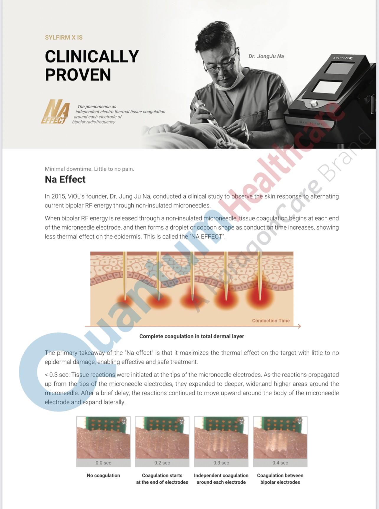 Update เทคนิคยกกระชับผิว หลุมสิว ดูแลปัญหาเม็ดสี ฝ้า+เส้นเลือด: SYLFIRM X นวัตกรรมคลื่นวิทยุแบบเข็ม (Fractional microneedle Radiofrequency) Update เทคนิคยกกระชับผิว หลุมสิว ดูแลปัญหาเม็ดสี ฝ้า+เส้นเลือด: SYLFIRM X นวัตกรรมคลื่นวิทยุแบบเข็ม (Fractional microneedle Radiofrequency)