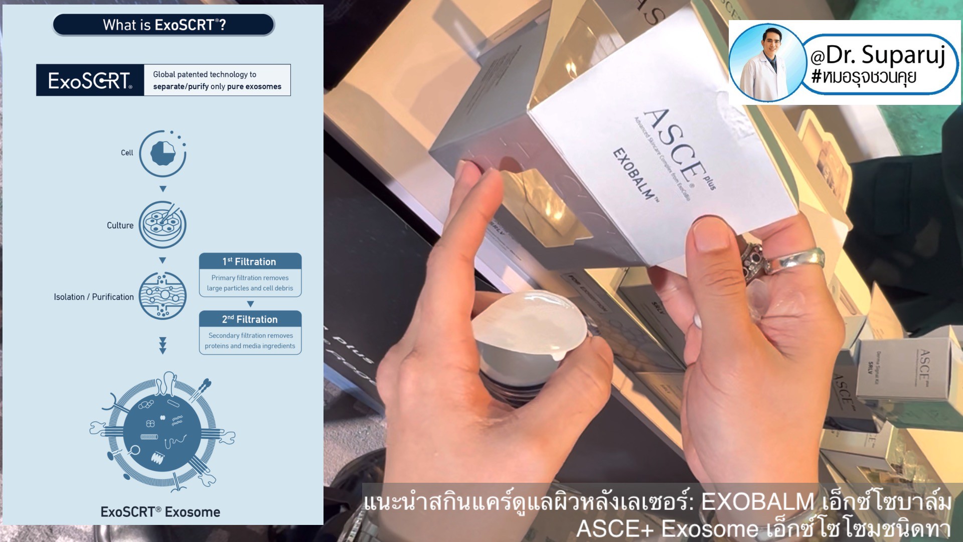 แนะนำสกินแคร์ดูแลผิวหลังเลเซอร์: EXOBALM เอ็กซ์โซบาล์ม ASCE+ Exosome เอ็กซ์โซโซมชนิดทา ดูแลผิวหลังเลเซอร์ ผิวหนังอักเสบ (+ สกินแคร์อื่นๆที่ใช้หลังเลเซอร์ )  แนะนำสกินแคร์ดูแลผิวหลังเลเซอร์: EXOBALM เอ็กซ์โซบาล์ม ASCE+ Exosome เอ็กซ์โซโซมชนิดทา ดูแลผิวหลังเลเซอร์ ผิวหนังอักเสบ (+ สกินแคร์อื่นๆที่ใช้หลังเลเซอร์ )