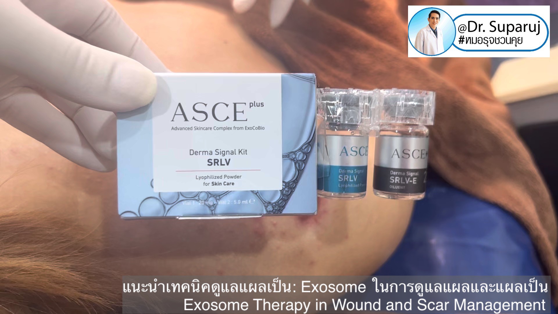 แนะนำเทคนิคดูแลแผลเป็น: Exosome ในการดูแลแผลและแผลเป็น Exosome Therapy in Wound and Scar Management