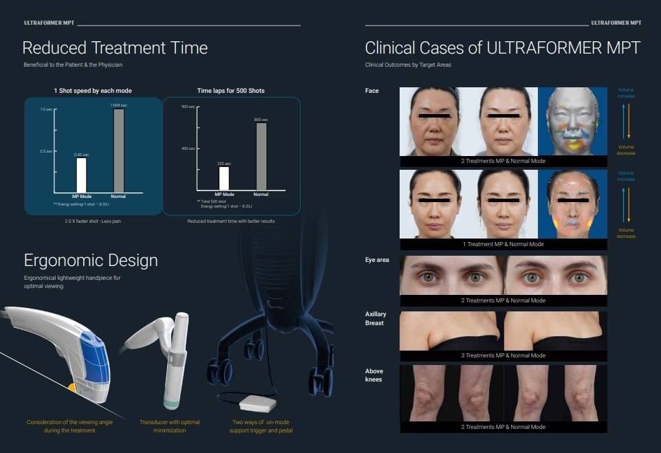 แนะนำนวัตกรรม Ultraformer MPT UltraBooster Pen-type Circular Headpiece สำหรับงานผิว (Ultraformer MPT Ultraboost Mode for Skin Tighthening & Brightening)  แนะนำนวัตกรรม Ultraformer MPT UltraBooster Pen-type Circular Headpiece สำหรับงานผิว (Ultraformer MPT Ultraboost Mode for Skin Tighthening & Brightening)