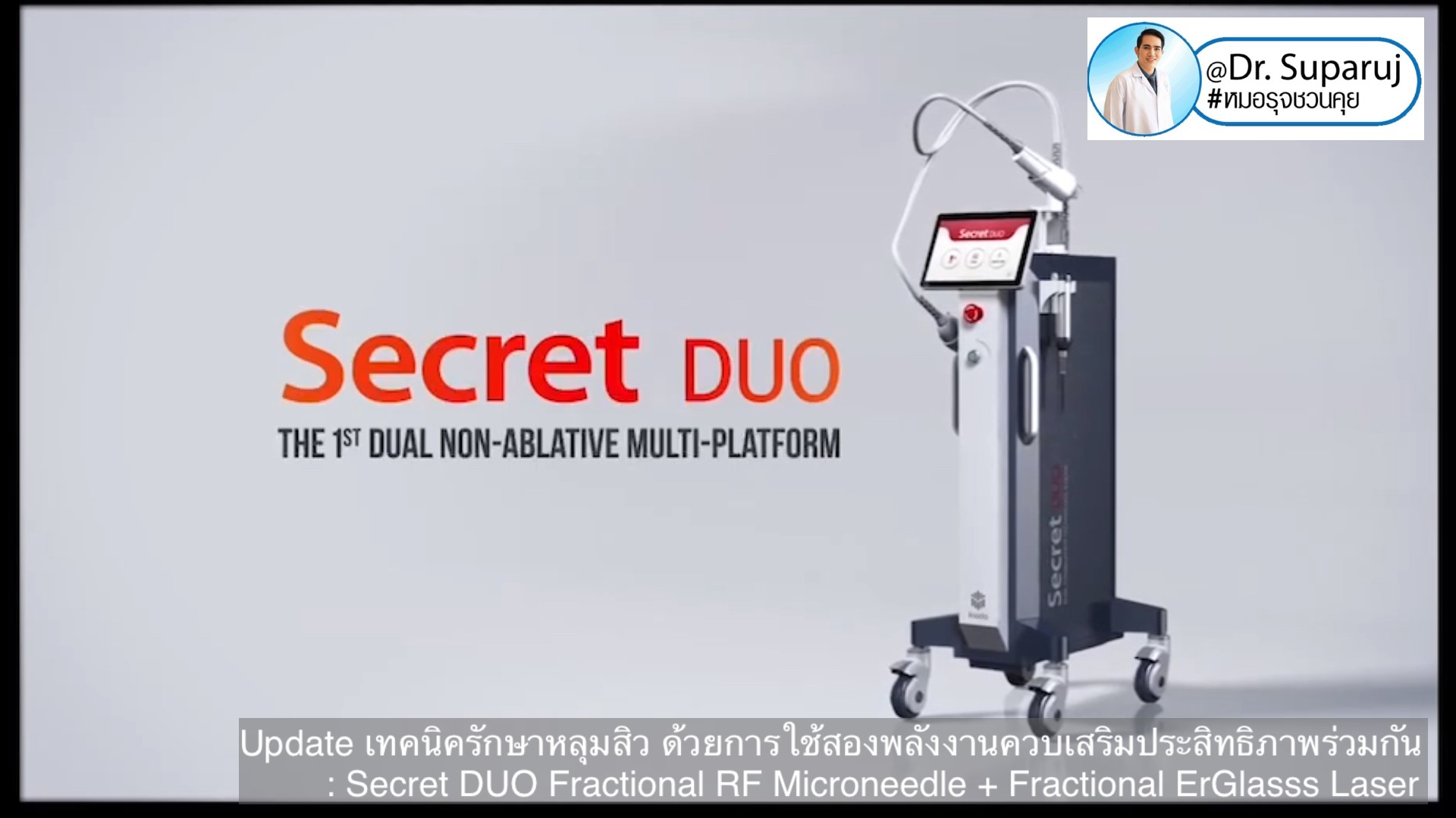 Update เทคนิครักษาหลุมสิว ด้วยการใช้สองพลังงานเสริมประสิทธิภาพร่วมกัน: Secret DUO Fractional RF Microneedle + Fractional ErGlasss Laser