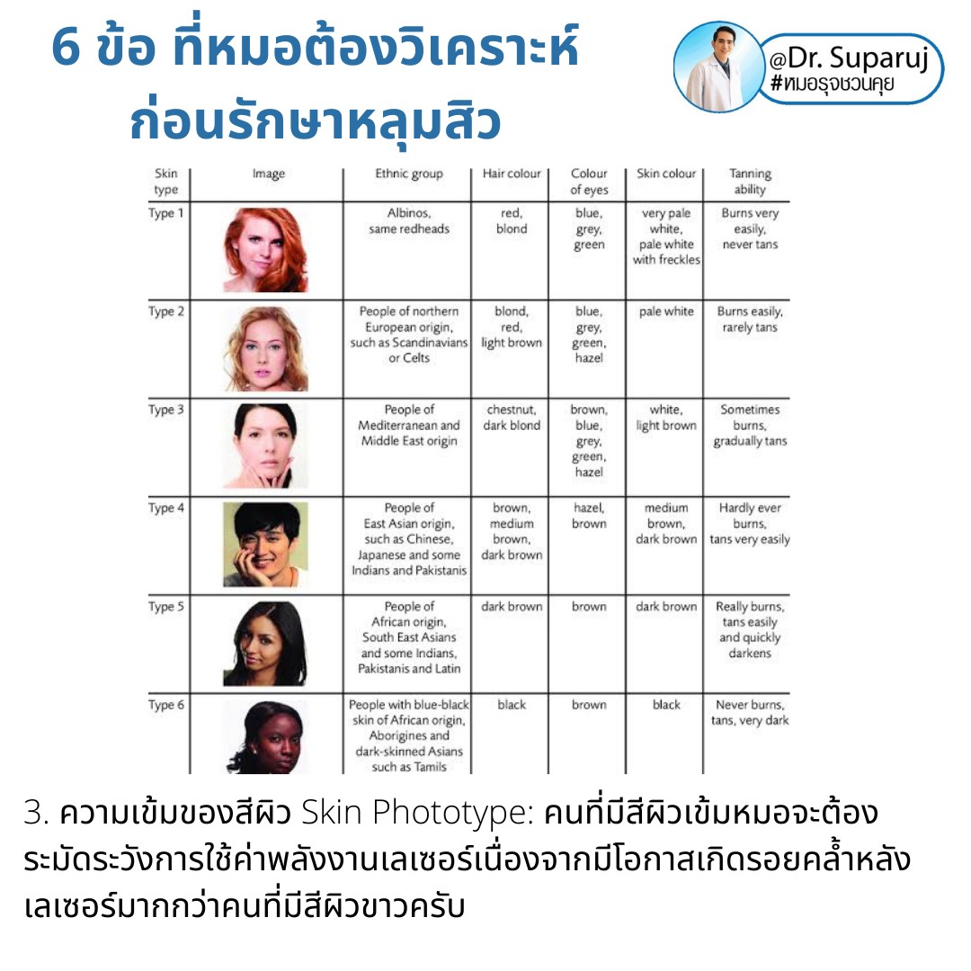 แนะนำเทคนิคดูแลหลุมสิว: เทคนิคการรักษาหลุมสิวชนิดไหนดีที่สุด? แนะนำเทคนิคดูแลหลุมสิว: เทคนิคการรักษาหลุมสิวชนิดไหนดีที่สุด?