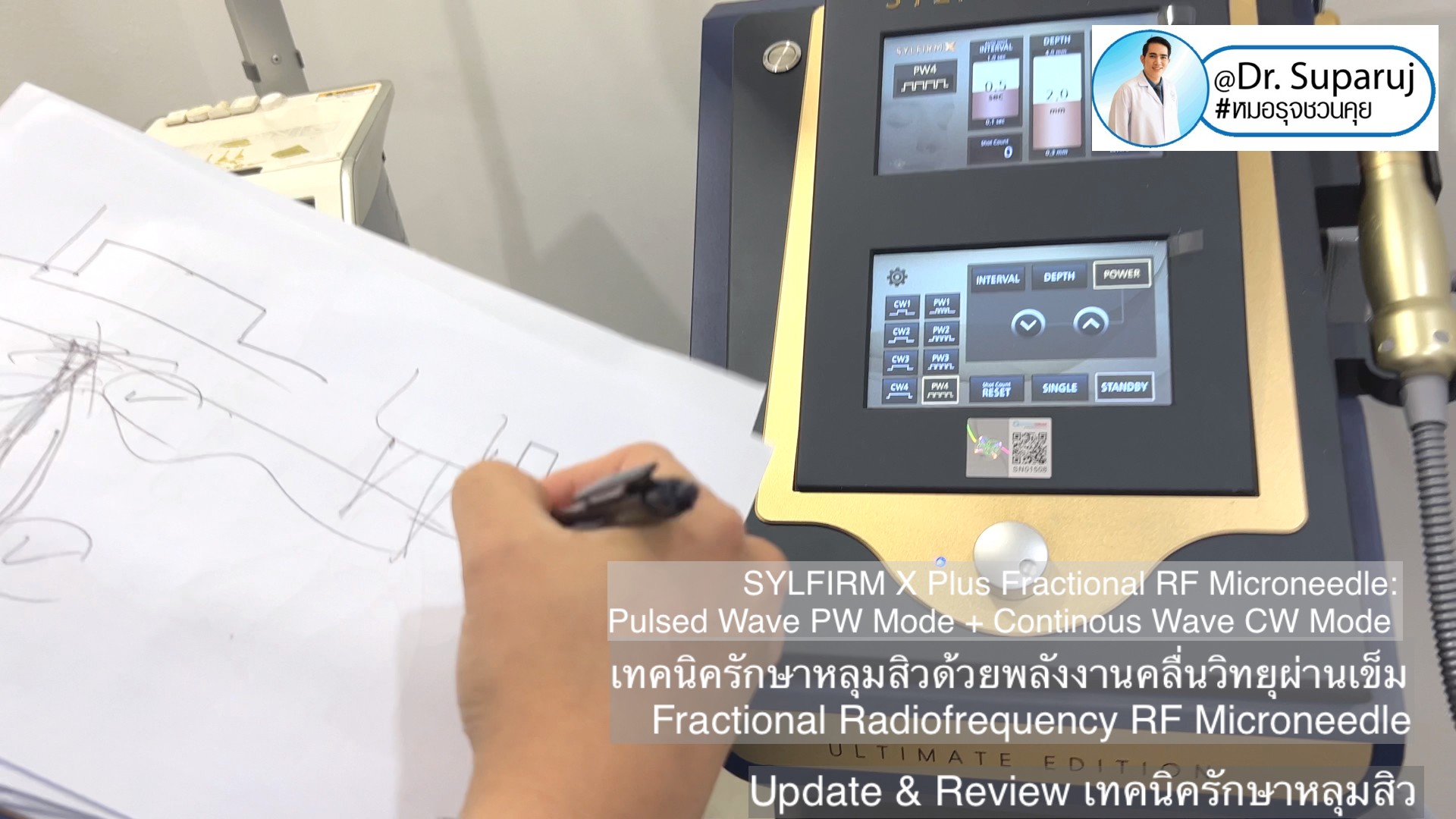 Update & Review เทคนิครักษาหลุมสิว (Acne Scar Treatment: Update & Review) Update & Review เทคนิครักษาหลุมสิว (Acne Scar Treatment: Update & Review)