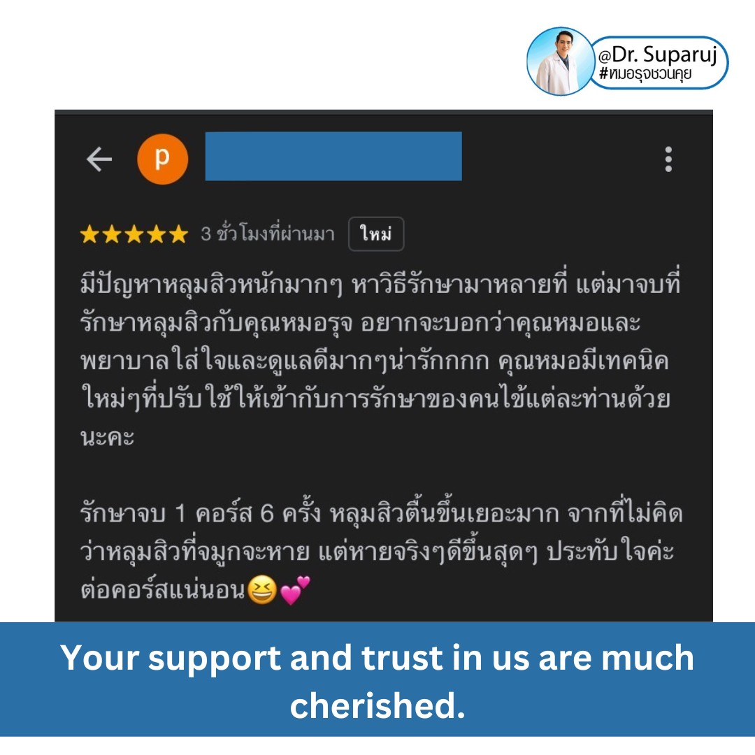 แนะนำเทคนิคดูแลรักษาหลุมสิว: เทคนิครักษาหลุมสิวด้วย 2 เทคนิคเสริมประสิทธิภาพ SYLFIRM X Plus + Discovery Pico Laser Combination Treatment แนะนำเทคนิคดูแลรักษาหลุมสิว: เทคนิครักษาหลุมสิวด้วย 2 เทคนิคเสริมประสิทธิภาพ SYLFIRM X Plus + Discovery Pico Laser Combination Treatment