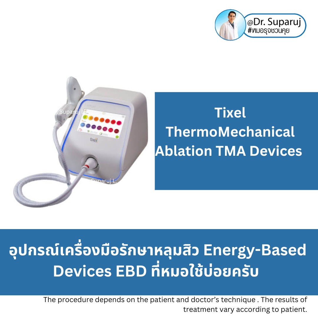 Update เทคนิคดูแลหลุมสิวที่หมอใช้บ่อยครับ (7/2023) Update เทคนิคดูแลหลุมสิวที่หมอใช้บ่อยครับ (7/2023)