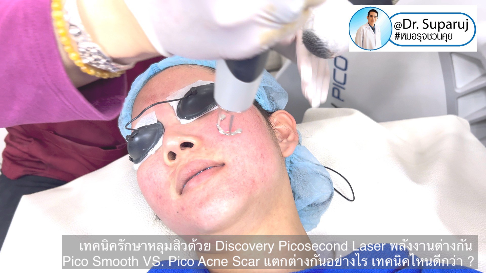 Q:Picosecond Laser หลุมสิวต้องยิงให้เลือดสาดไหม? Q:Picosecond Laser หลุมสิวต้องยิงให้เลือดสาดไหม?