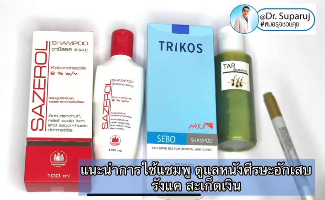 แนะนำเทคนิคการใช้แชมพู ดูแลหนังศีรษะอักเสบ รังแค เซ็บเดิร์ม สะเก็ดเงิน แนะนำเทคนิคการใช้แชมพู ดูแลหนังศีรษะอักเสบ รังแค เซ็บเดิร์ม สะเก็ดเงิน