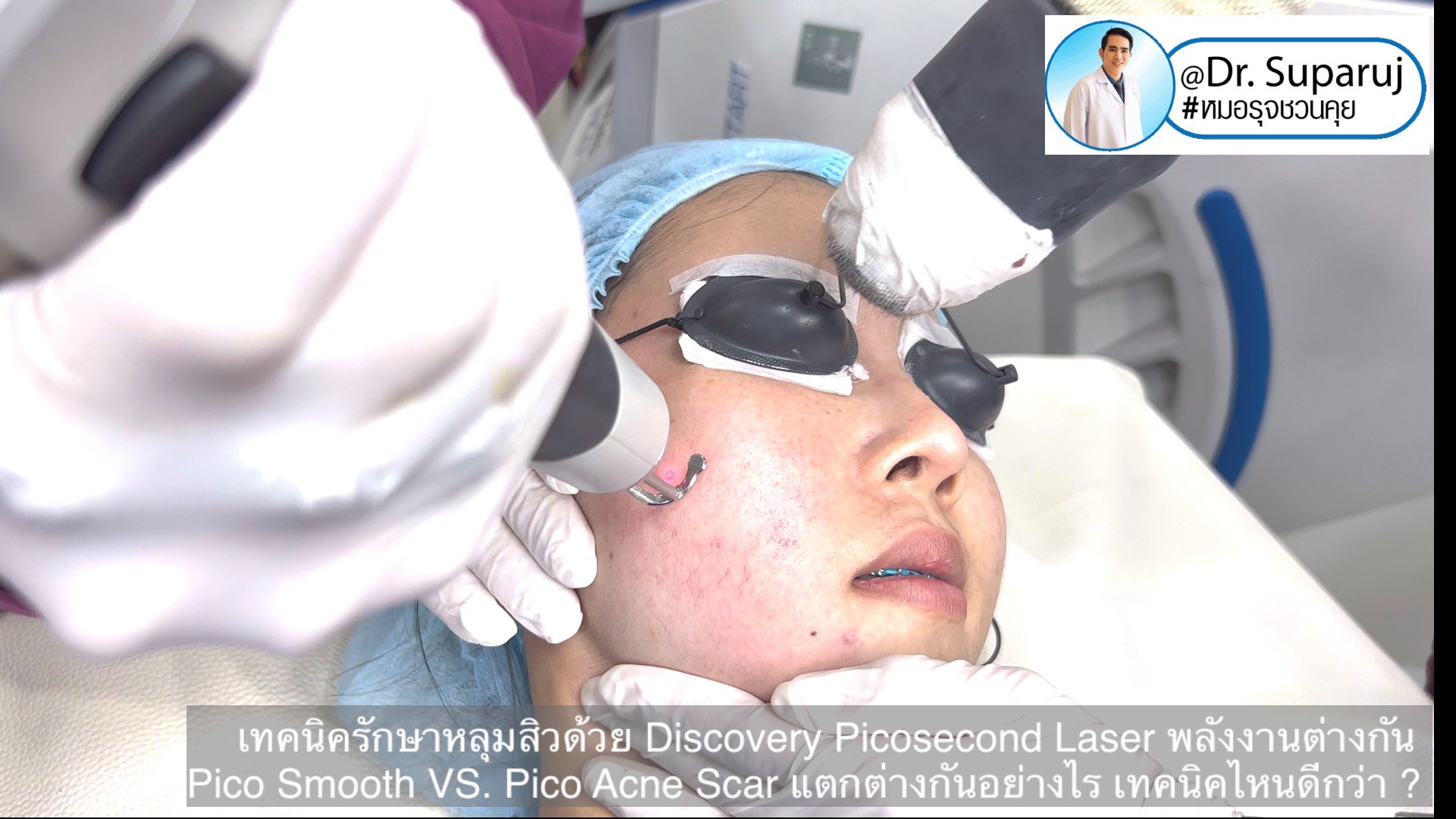 Q:Picosecond Laser หลุมสิวต้องยิงให้เลือดสาดไหม? Q:Picosecond Laser หลุมสิวต้องยิงให้เลือดสาดไหม?