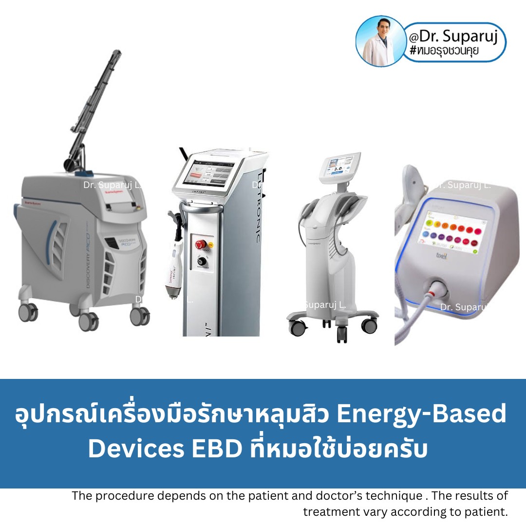 Update เทคนิคดูแลหลุมสิวที่หมอใช้บ่อยครับ (7/2023) Update เทคนิคดูแลหลุมสิวที่หมอใช้บ่อยครับ (7/2023)
