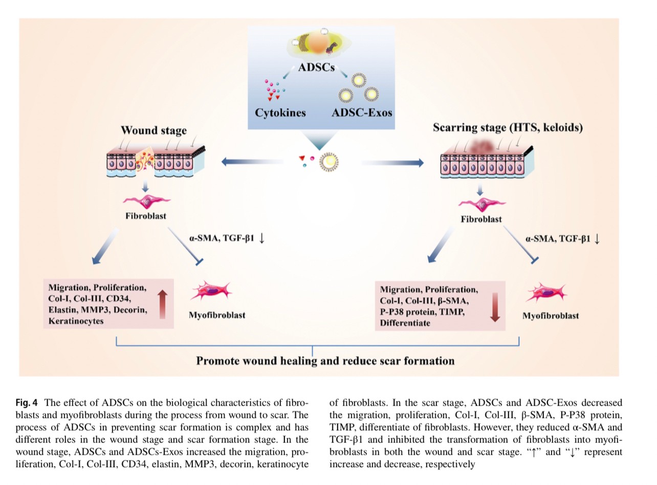 แนะนำเทคนิคดูแลแผลเป็น: Exosome ในการดูแลแผลและแผลเป็น Exosome Therapy in Wound and Scar Management แนะนำเทคนิคดูแลแผลเป็น: Exosome ในการดูแลแผลและแผลเป็น Exosome Therapy in Wound and Scar Management