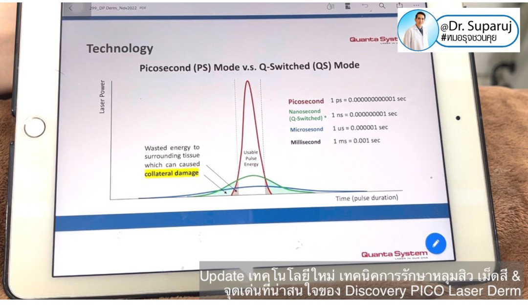 Update เทคโนโลยีใหม่ เทคนิคการรักษาหลุมสิว เม็ดสี & จุดเด่นที่น่าสนใจของ Discovery PICO Laser Derm Update เทคโนโลยีใหม่ เทคนิคการรักษาหลุมสิว เม็ดสี & จุดเด่นที่น่าสนใจของ Discovery PICO Laser Derm