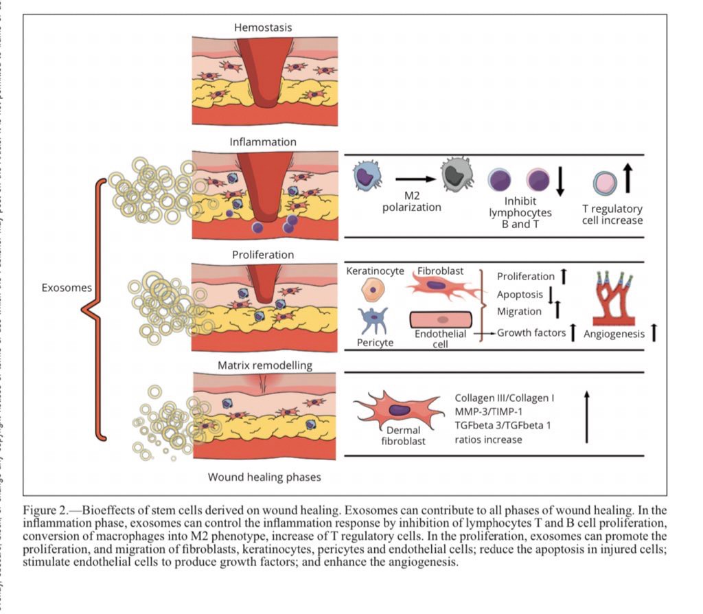 แนะนำเทคนิคในการดูแลหลุมสิว: Exosome ใน การรักษาหลุมสิว (Exosome & acne scar treatment)