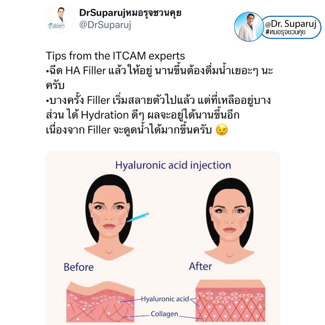 Update เทคนิคกระตุ้นการสร้างคอลลาเจนในผิวหนังลดเลือนริ้วรอย: Collagen Biostimulator Update เทคนิคกระตุ้นการสร้างคอลลาเจนในผิวหนังลดเลือนริ้วรอย: Collagen Biostimulator