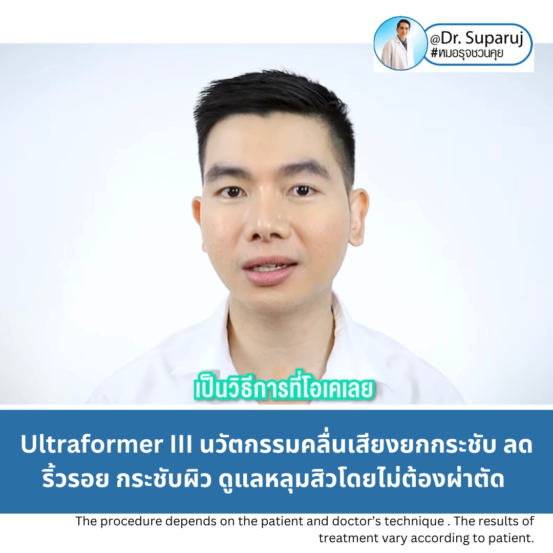 Update ผลการยกกระชับผิวด้วย Ultraformer III (เปรียบเทียบแบบครึ่งหน้าให้เห็นชัดๆครับ) Update ผลการยกกระชับผิวด้วย Ultraformer III (เปรียบเทียบแบบครึ่งหน้าให้เห็นชัดๆครับ)