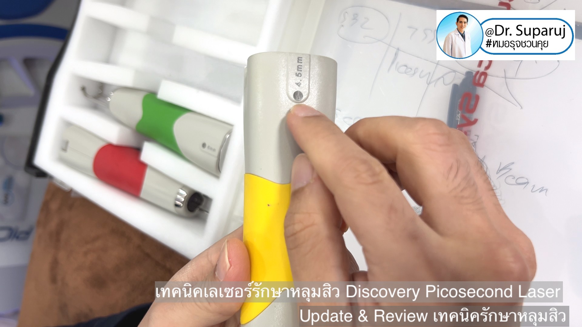 Update & Review เทคนิครักษาหลุมสิว (Acne Scar Treatment: Update & Review) Update & Review เทคนิครักษาหลุมสิว (Acne Scar Treatment: Update & Review)