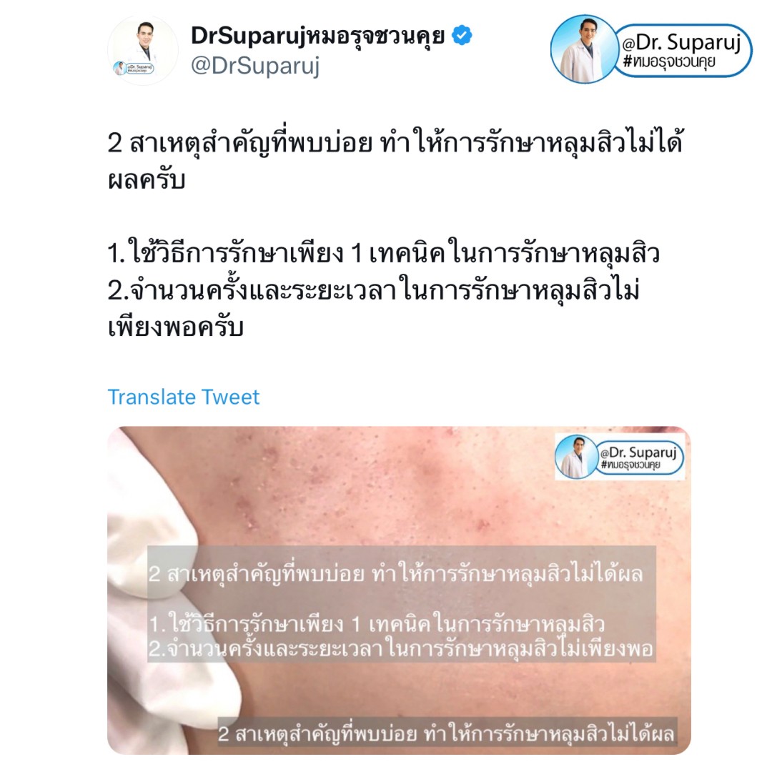 เป็นหลุมสิว แต่ยังไม่พร้อมรักษาหลุมสิว ทำอย่างไรดี? (+ เทคนิคการ เลือกใช้วิธีรักษาลุมสิวเบื้องต้นครับ)