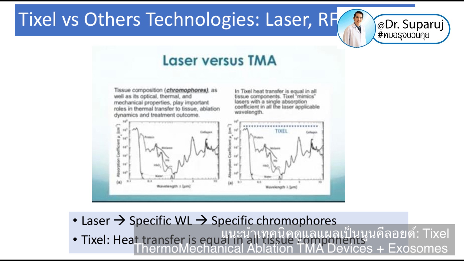 แนะนำเทคนิคดูแลแผลเป็นนูนคีลอยด์: รักษาแผลเป็นนูนด้วยทิกเซลล์ Tixel Fractional ThermoMechanical Ablation Devices + Exosomes แนะนำเทคนิคดูแลแผลเป็นนูนคีลอยด์: รักษาแผลเป็นนูนด้วยทิกเซลล์ Tixel Fractional ThermoMechanical Ablation Devices + Exosomes
