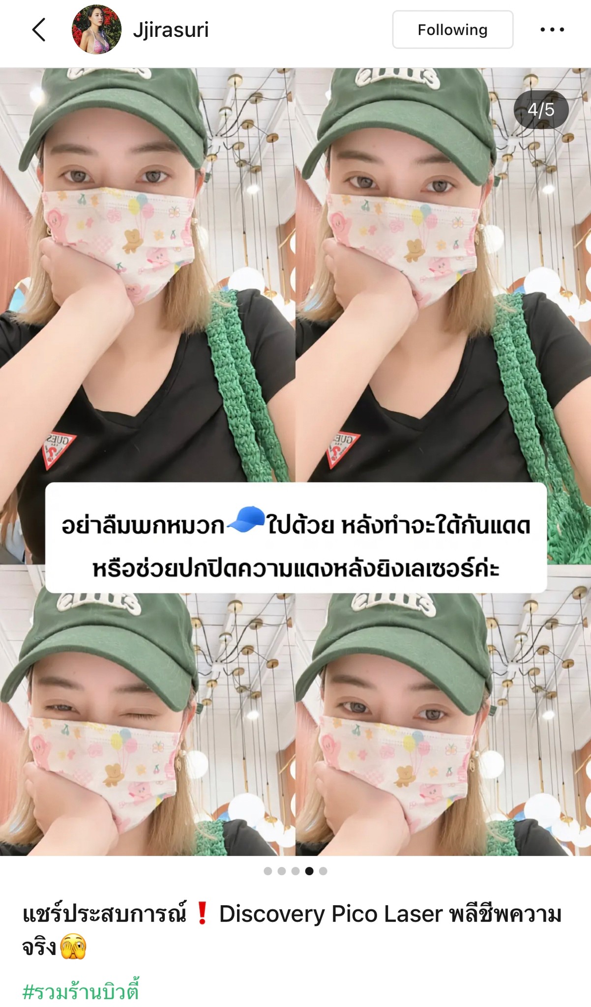 แชร์ประสบการณ์ Discovery Pico Laser พลีชีพความจริง แชร์ประสบการณ์ Discovery Pico Laser พลีชีพความจริง