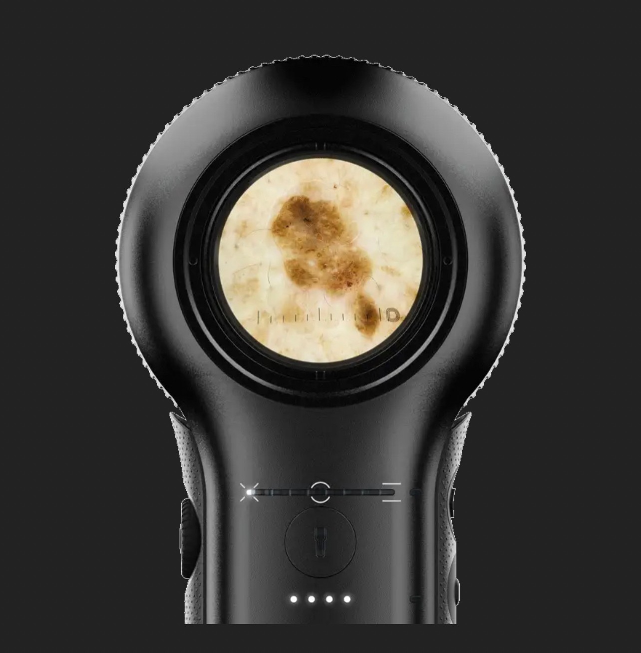 Update เทคนิคดูแลปัญหาผิวหนัง:กล้องส่องขยายพิเศษทางผิวหนัง Dermlite DL5 Dermopcopy Update เทคนิคดูแลปัญหาผิวหนัง:กล้องส่องขยายพิเศษทางผิวหนัง Dermlite DL5 Dermopcopy