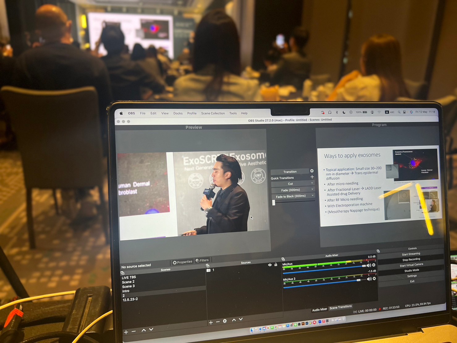 ผศ.นพ. ศุภะรุจ เลื่องอรุณ (หมอรุจ) ได้รับเชิญเป็นวิทยากร แชร์เทคนิคๆการดูแลหลุมสิว แผลเป็น ผมร่วงผมบางด้วยการใช้ Exosomes ในงานสัมมนา The Aesthetic Secret of Exosome based on Scientific Data ผศ.นพ. ศุภะรุจ เลื่องอรุณ (หมอรุจ) ได้รับเชิญเป็นวิทยากร แชร์เทคนิคๆการดูแลหลุมสิว แผลเป็น ผมร่วงผมบางด้วยการใช้ Exosomes ในงานสัมมนา The Aesthetic Secret of Exosome based on Scientific Data