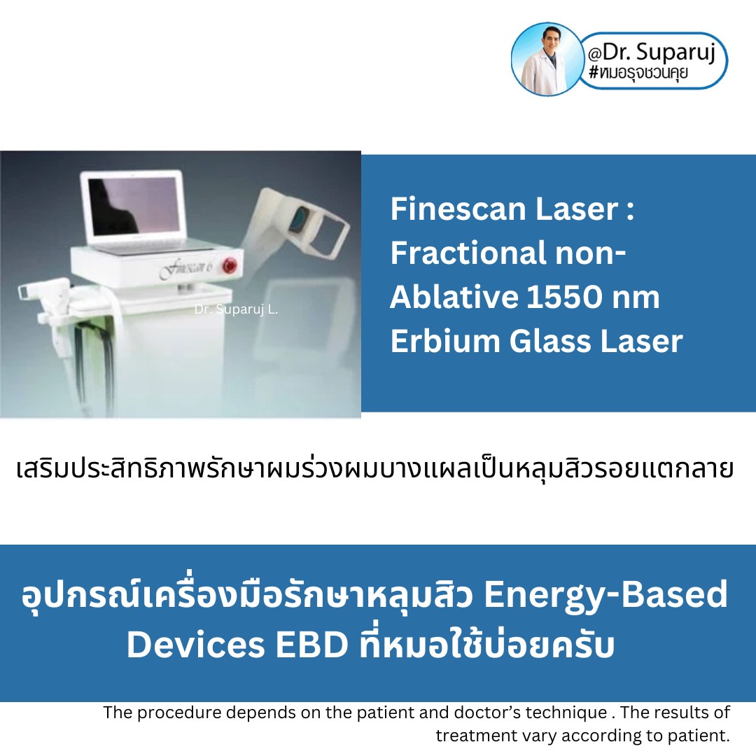 Update Energy-based Devices EBD อุปกรณ์เครื่องมือ ที่มีให้การดูแลรักษา ปัญหาผิว หลุมสิว ผมร่วงผมบาง แผลเป็น ขนคุดครับ (Update November 2023) Update Energy-based Devices EBD อุปกรณ์เครื่องมือ ที่มีให้การดูแลรักษา ปัญหาผิว หลุมสิว ผมร่วงผมบาง แผลเป็น ขนคุดครับ (Update November 2023)