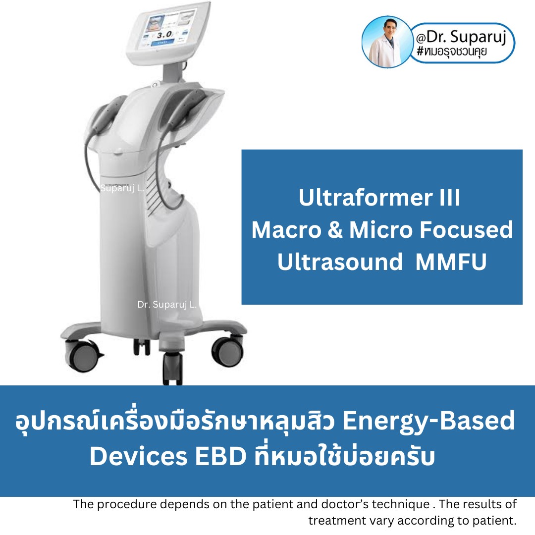 Update เทคนิคดูแลหลุมสิวที่หมอใช้บ่อยครับ (7/2023)