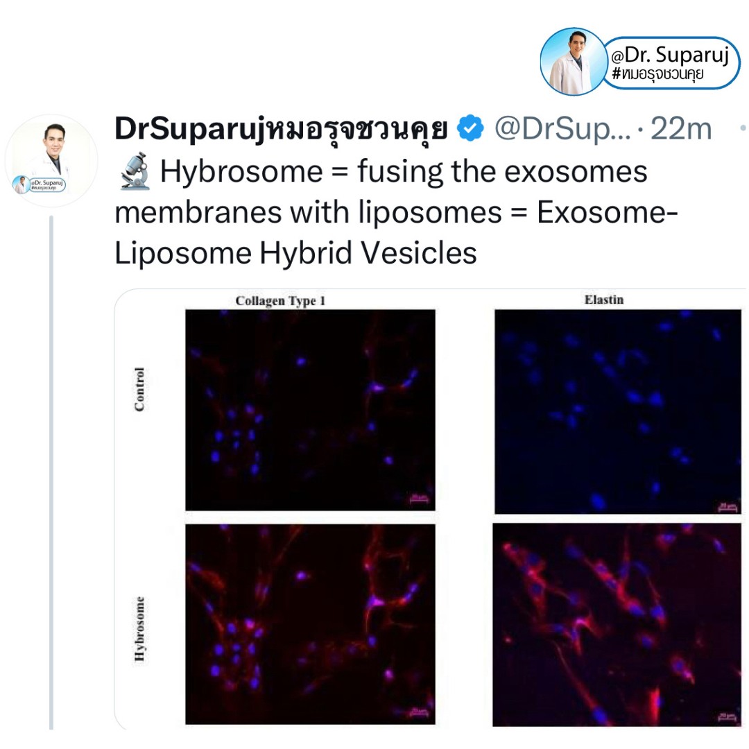 Update เทคนิคกระตุ้นการสร้างคอลลาเจนในผิวหนังลดเลือนริ้วรอย: Collagen Biostimulator Update เทคนิคกระตุ้นการสร้างคอลลาเจนในผิวหนังลดเลือนริ้วรอย: Collagen Biostimulator