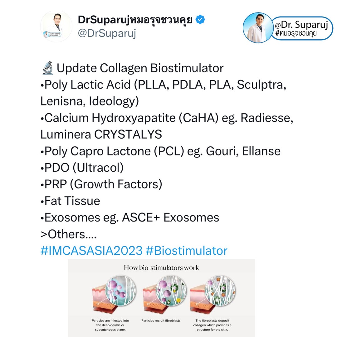 Update เทคนิคกระตุ้นการสร้างคอลลาเจนในผิวหนังลดเลือนริ้วรอย: Collagen Biostimulator Update เทคนิคกระตุ้นการสร้างคอลลาเจนในผิวหนังลดเลือนริ้วรอย: Collagen Biostimulator