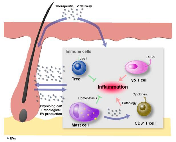 แนะนำเทคนิคดูแลปัญหาผมร่วงผมบาง: Exosome เอ็กโซโซม ช่วยดูแลผมร่วงผมบางได้อย่างไร Exosome Therapy for Hair Loss