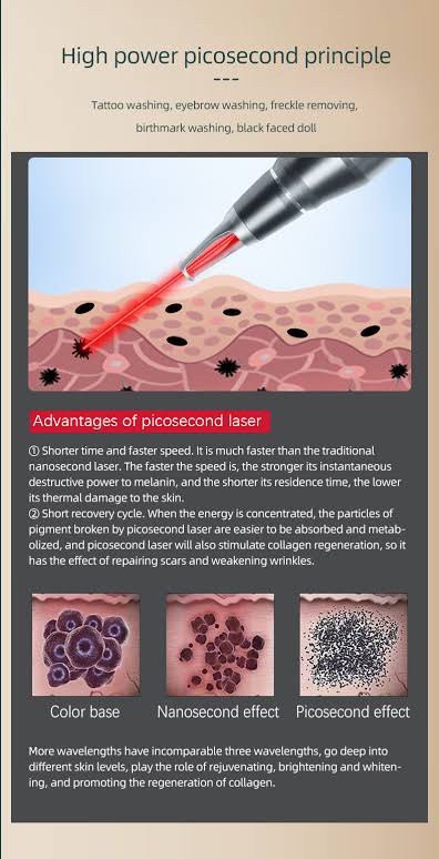 เทคนิคเลเซอร์ลบรอยสักคิ้วด้วย Discovery Picosecond Laser (Discovery Picosecond Laser for Eyebrow Tattoo Removal) เทคนิคเลเซอร์ลบรอยสักคิ้วด้วย Discovery Picosecond Laser (Discovery Picosecond Laser for Eyebrow Tattoo Removal)