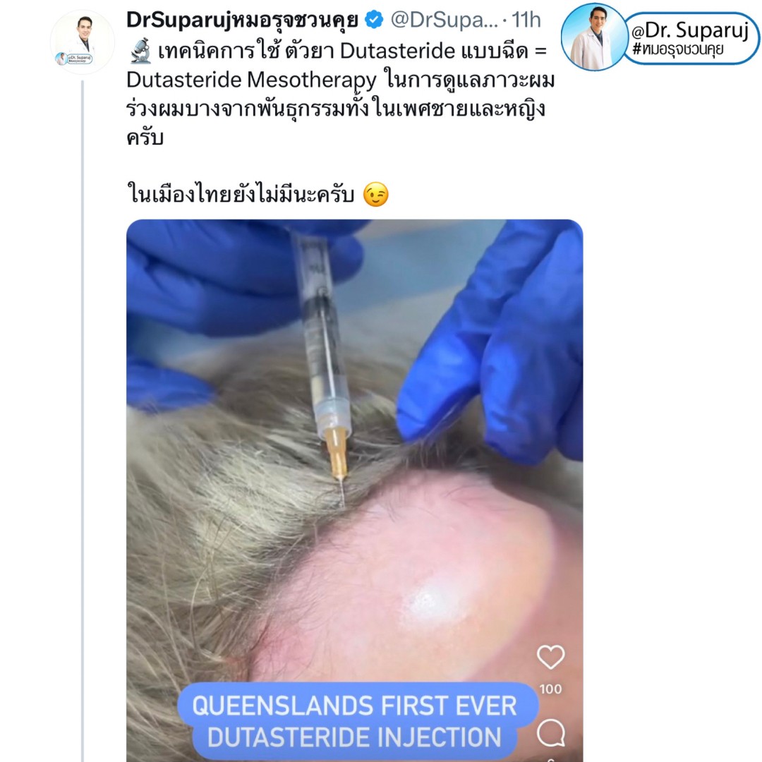 Update เทคนิค (เสริม)ดูแลผมร่วงผมบางจากพันธุกรรม AGA Update เทคนิค (เสริม)ดูแลผมร่วงผมบางจากพันธุกรรม AGA